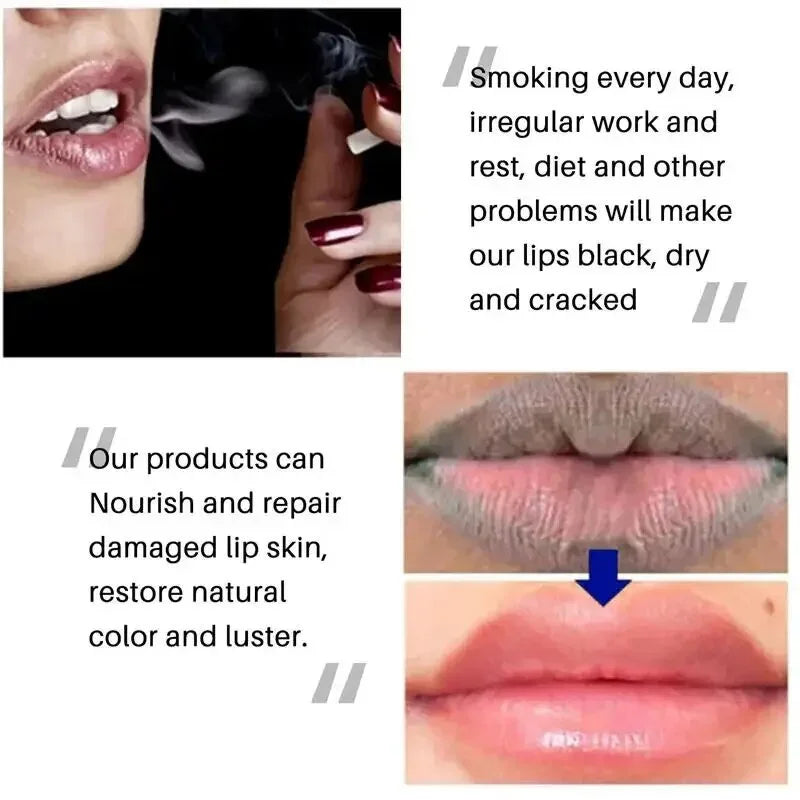 Lip Balm Whitening - Moisturizing Dead Skin Remover