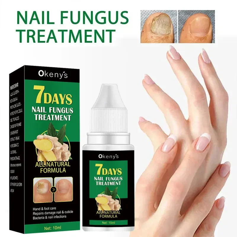 Anti Infection Essence Oil Toe Fungus Removal