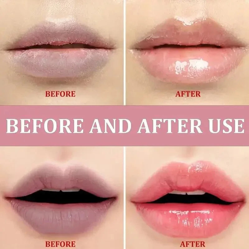 Lip Balm Whitening - Moisturizing Dead Skin Remover